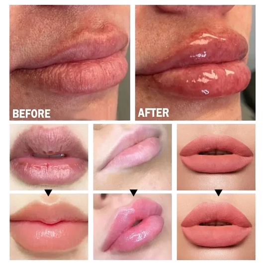 Top-5-Lip-Plumping-Benefits-That-Transform-Your-Lip-Game Prettybloom